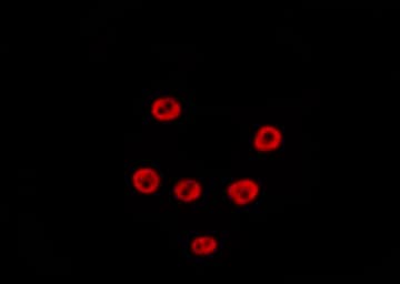 POLR1E Antibody
