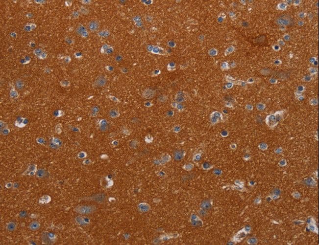 NOX3 Antibody