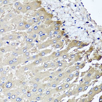 MGAT / GLYT1 Antibody