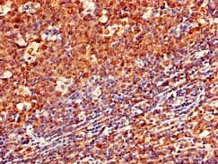 CD79A / CD79 Alpha Antibody