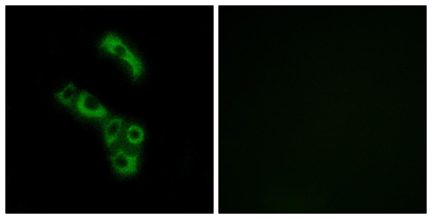 Complement C1QB Antibody