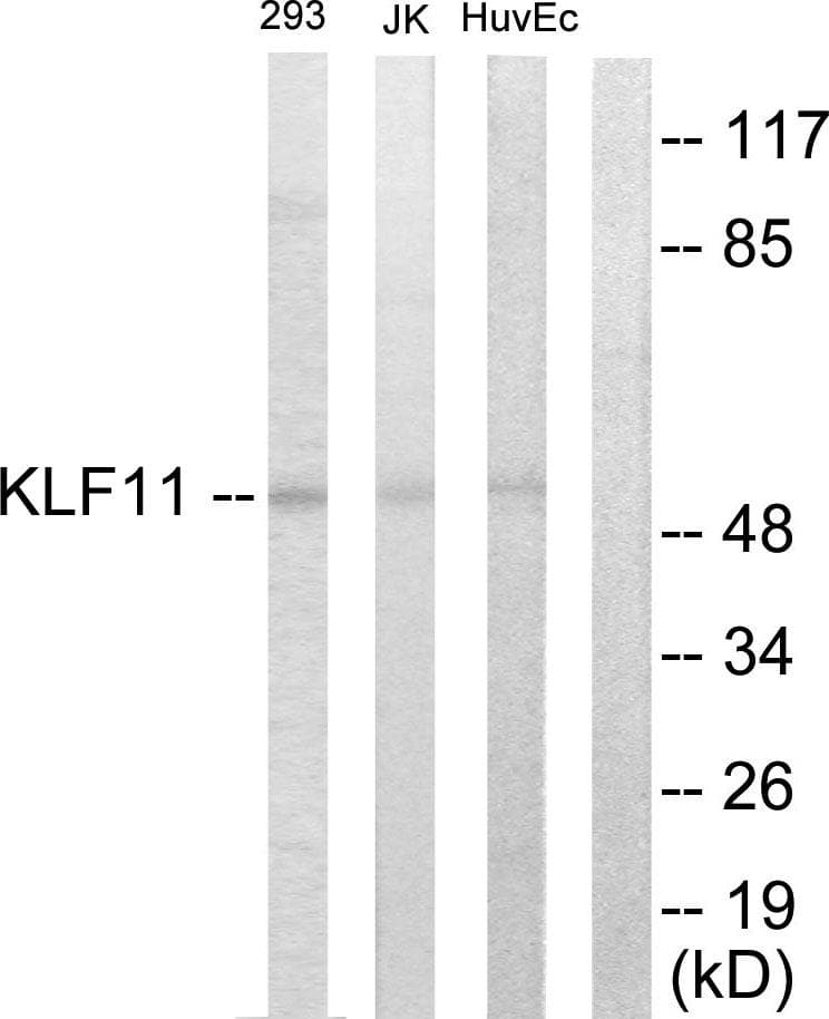 Polyclonal Rabbit anti-Human KLF11 Antibody (WB)