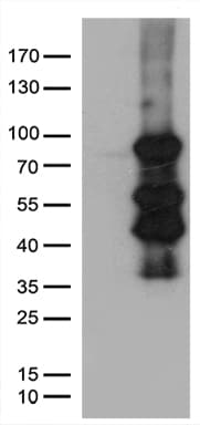 ELL / MEN Antibody (aa302-621, clone OTI1G2)