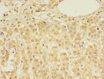 Polyclonal Rabbit anti-Human DHRSX Antibody (IHC)