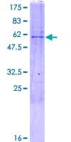 Human DOK5 Protein (Recombinant GST)