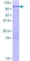 Human SOX9 Protein (Recombinant GST)