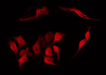 TACC1 Antibody