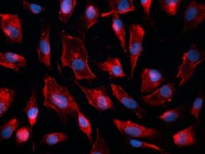 CAV1 / Caveolin 1 Antibody (clone 7C8, DY488)
