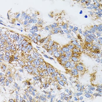 Polyclonal Rabbit anti-Human PDYN / ProDynorphin Antibody (IHC, WB)