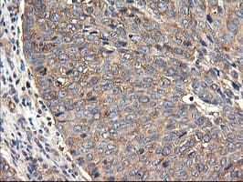 TUBAL3 Antibody (clone OTI4D8)