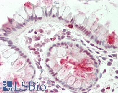 TSC22D1 / TSC22 Antibody (aa35-84)