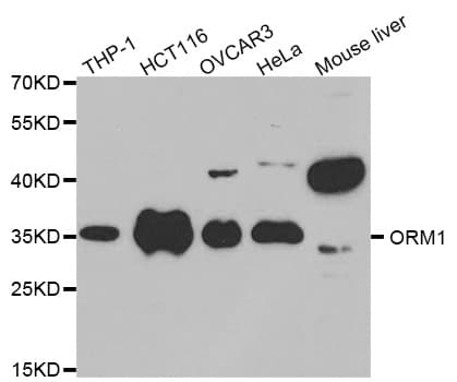 ORM1 / Orosomucoid Antibody