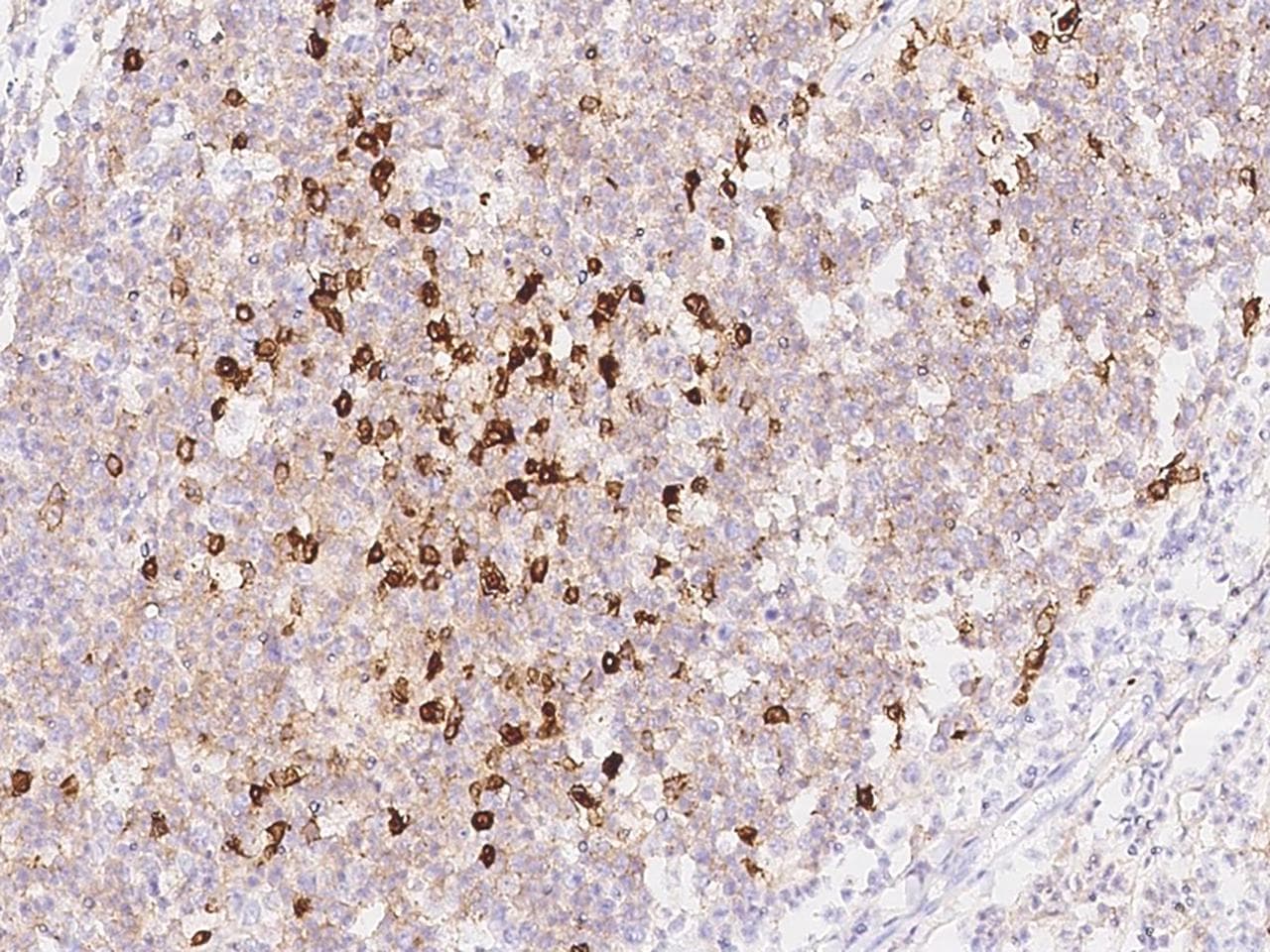 CD38 Antibody (Preservative Free)