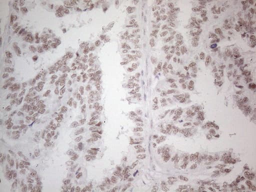 NR2C2 / TAK1 Antibody (aa1-241, clone OTI2H2)