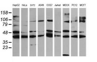 MAP2K1 / MKK1 / MEK1 Antibody (clone OTI4E4)