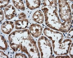 PSMC3 Antibody (clone OTI9C11)