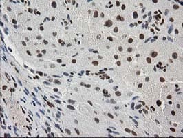 MEF2C Antibody (clone OTI4F7)