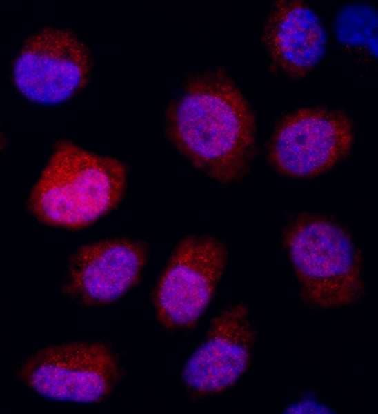 DDIT4 / REDD1 Antibody (aa1-50)