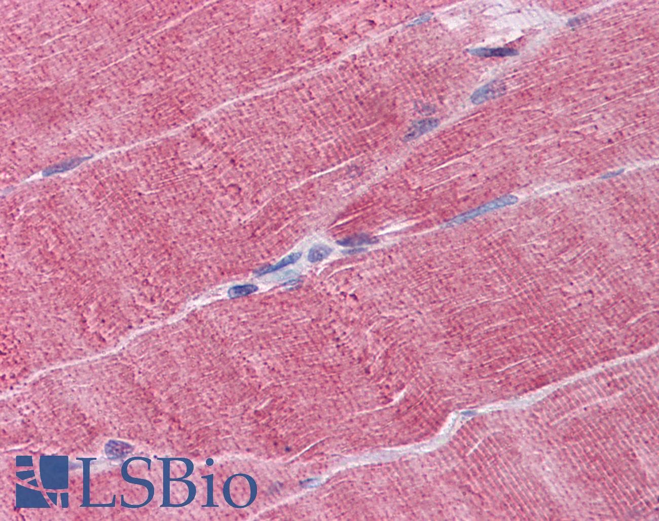IHC-plus™ Monoclonal Mouse anti-Human WDR77 / MEP50 Antibody (clone 3F10, IHC, WB)