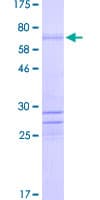 Human ISLET-1 / ISL1 Protein (Recombinant GST)
