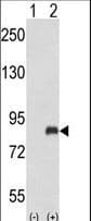 ADRBK2 / GRK3 Antibody (aa29-57)