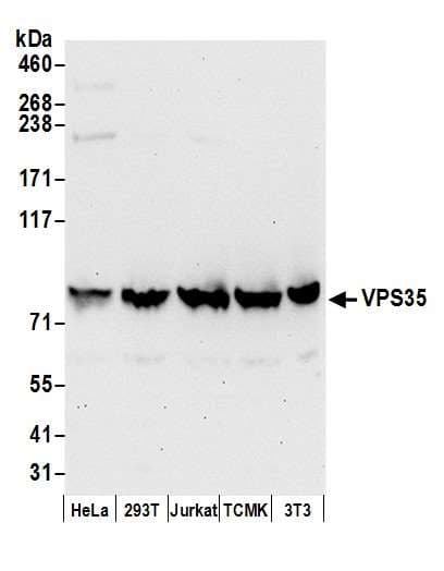 VPS35 Antibody (aa746-796)