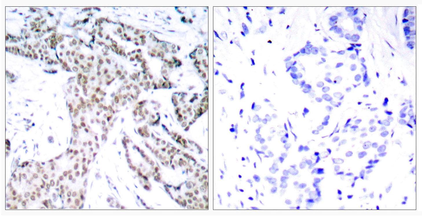 STAT3 Antibody (phospho-Ser727)