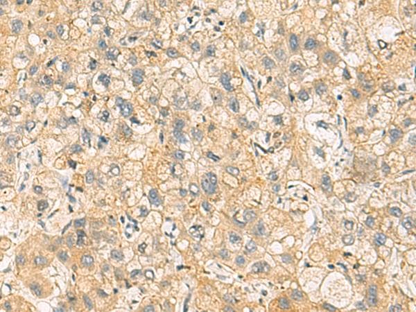 NANP Antibody