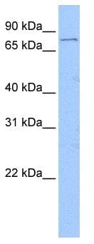Polyclonal Rabbit anti-Human FOXM1 Antibody (C-Terminus, IHC, WB)