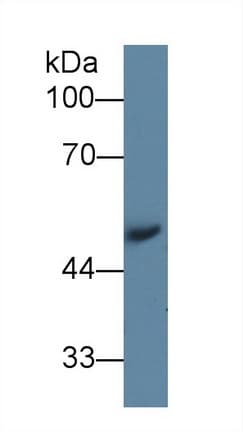 AGT / Angiotensinogen Antibody (aa23-477)