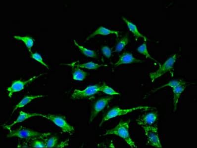 IHC-plus™ IFNA2 / Interferon Alpha 2 Antibody