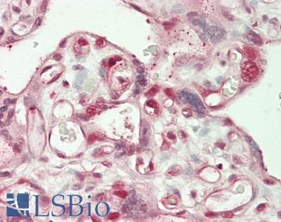 IHC-plus™ Polyclonal Rabbit anti-Human CTNNBL1 / NAP Antibody (aa1-50, IHC, WB)