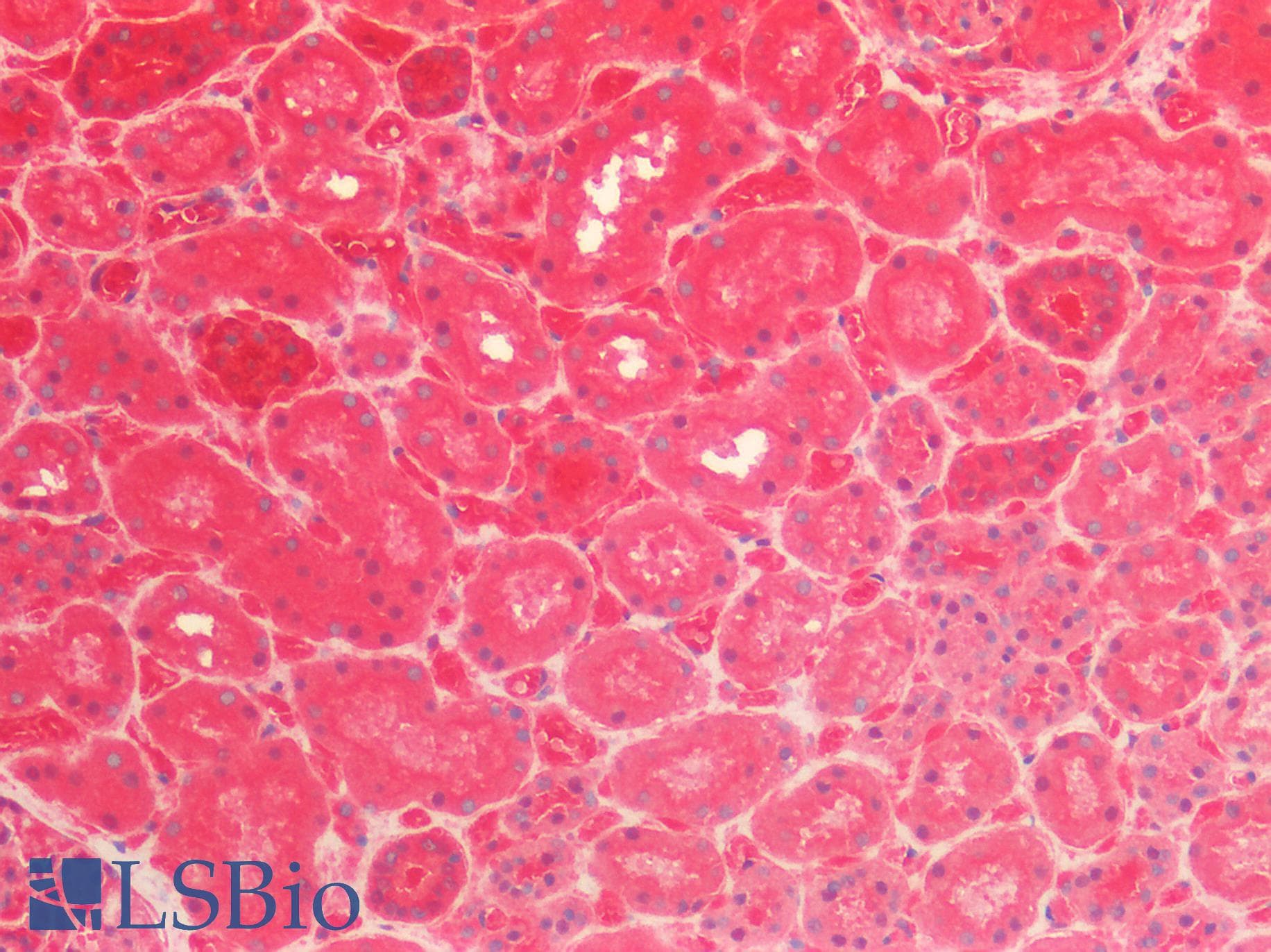 PathPlus™ CALB1 / Calbindin Antibody (aa3-261)