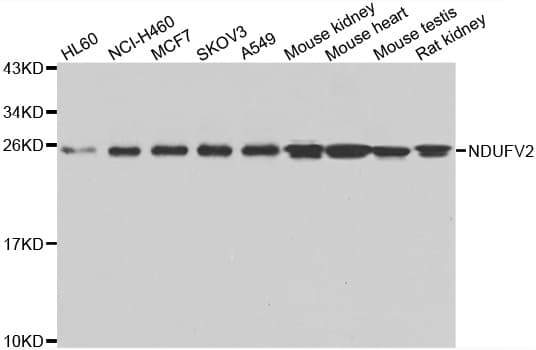 NDUFV2 Antibody