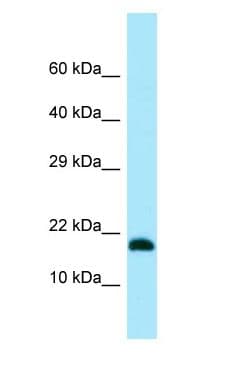 Polyclonal Rabbit anti-Human MMS2 / UBE2V2 Antibody (aa12-61, WB)