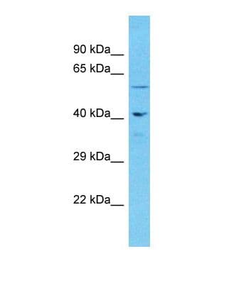 Polyclonal Rabbit anti-Human NUP62 Antibody (aa311-360, WB)