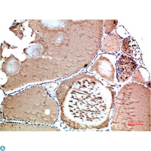 TTR / Transthyretin Antibody
