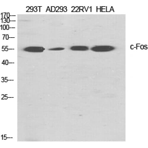 Polyclonal Rabbit anti-Human FOS / c-FOS Antibody (300-380 aa, IHC, WB)