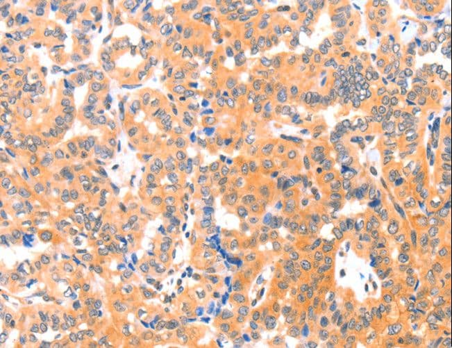 THBS1 / Thrombospondin-1 Antibody