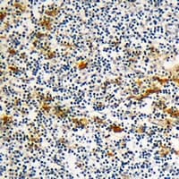 DOK6 Antibody (Internal)