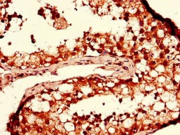 Polyclonal Rabbit anti-Human DGAT2 Antibody (IHC, IF, WB)