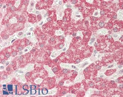 IHC-plus™ Polyclonal Rabbit anti-Human IL25 / IL17E Antibody (aa33-177, IHC)