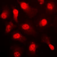 Polyclonal Rabbit anti-Human PRKAA1 / AMPK Alpha 1 Antibody (phospho-Ser496, IHC, IF, WB)