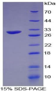 Human FGG / Fibrinogen Gamma Protein (Recombinant His)