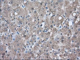 PIM2 / Pim-2 Antibody (clone OTI9A5)