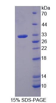 Human GNB3 Protein (Recombinant His, N-Terminal)