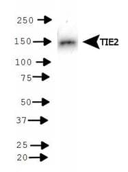 TEK / TIE2 Antibody (DY488)