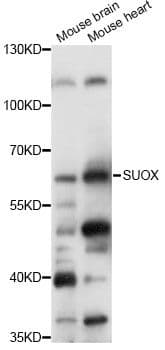 SUOX / Sulfite Oxidase Antibody