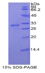Rat PNMA2 / MA2 Protein (Recombinant His)