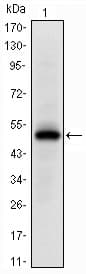 IHC-plus™ EPHA10 / EPH Receptor A10 Antibody (clone 2E8)